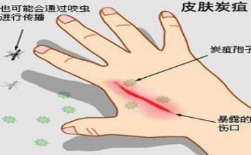 防治传染病工作计划5篇