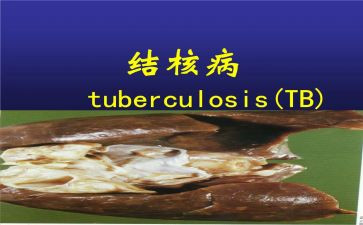 结核病工作总结6篇